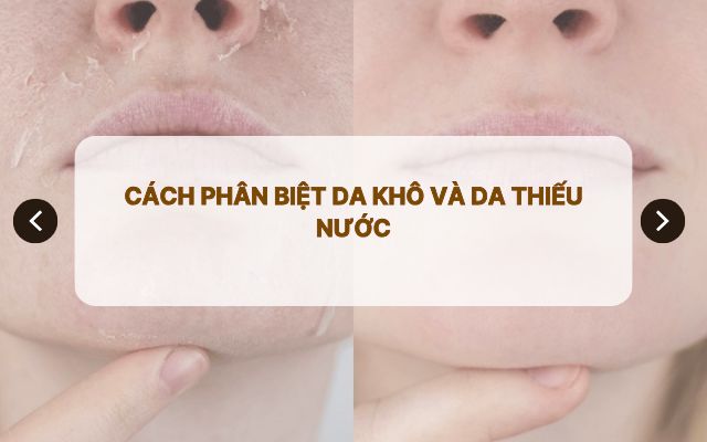 Cách phân biệt da khô và da thiếu nước