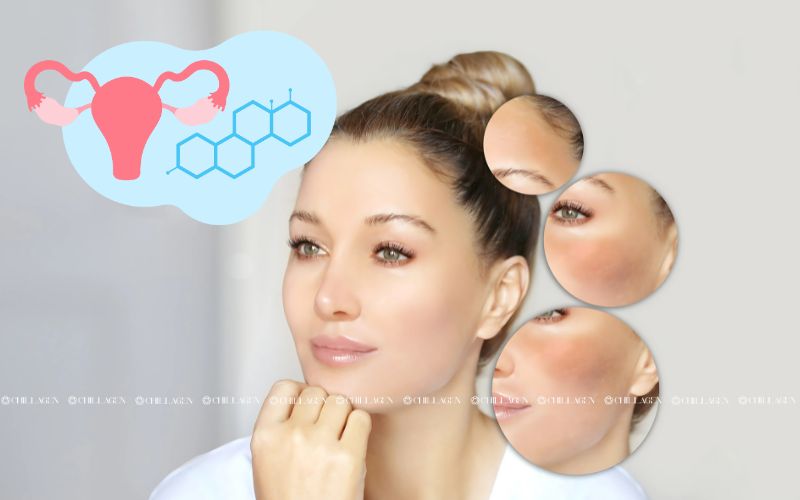 Lý do cây Trà Hoa Vàng Cổ Thụ được giới Y Học Và Dược Liệu săn đón 6 Lý do cây Trà Hoa Vàng Cổ Thụ được giới Y Học Và Dược Liệu săn đón