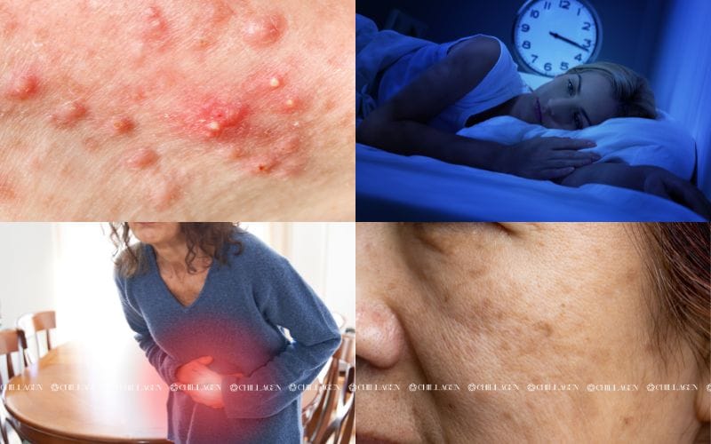 Cách làm sạch cơ thể từ bên trong: Giải độc, dưỡng da, thanh lọc cơ thể 2 Cách Làm Sạch Cơ Thể Từ Bên Trong: Giải Độc, Dưỡng Da Và Tăng Cường Sức Khỏe