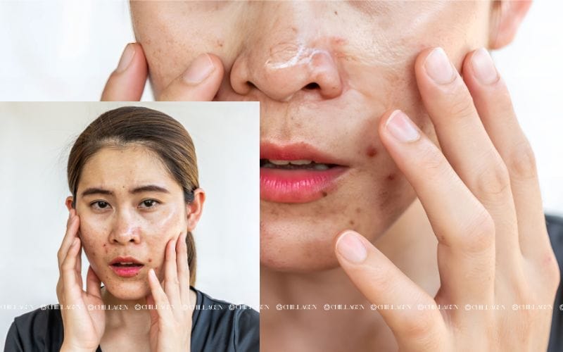 Skincare Tối Giản Cho Da Dầu – Quy Trình Chăm Sóc Da Hiệu Quả Trong 4 Bước