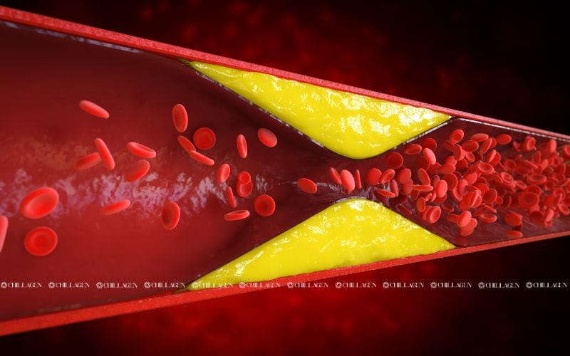 Trà Hoa Vàng Hỗ Trợ Hạ Huyết Áp – Bí Quyết Tự Nhiên Cho Tim Mạch Khỏe Mạnh