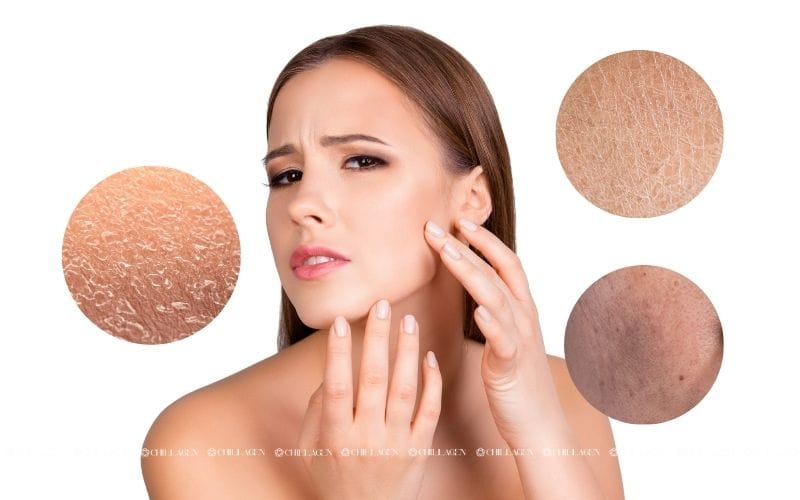 Cách chăm sóc da khô sạm hiệu quả: Lấy lại làn da mịn màng và rạng rỡ