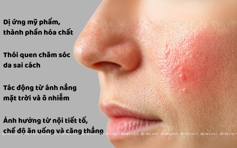 Cách chăm sóc da kích ứng hiệu quả: Giảm đỏ rát và phục hồi làn da nhạy cảm