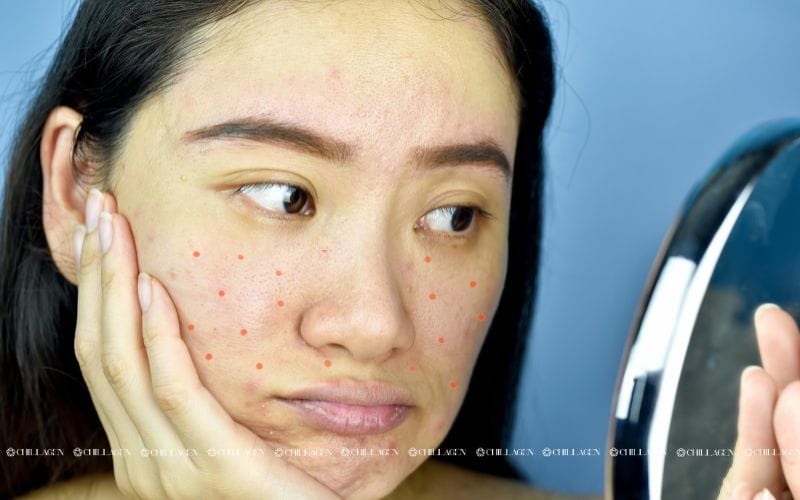 Cách chăm sóc da kích ứng hiệu quả: Giảm đỏ rát và phục hồi làn da nhạy cảm