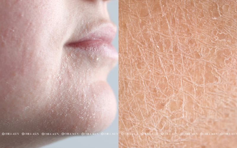 Cách cấp ẩm tức thì cho da khi ngồi máy lạnh: Giải pháp giữ da luôn mềm mịn 1 Cách cấp ẩm tức thì cho da khi ngồi máy lạnh: Giải pháp giữ da luôn mềm mịn