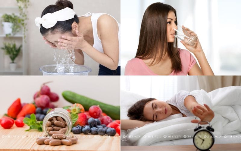 Da nổi mẩn do nội tiết phải làm sao? Giải pháp chăm sóc da và cân bằng từ bên trong