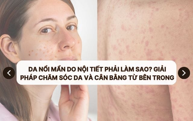 da noi man do noi tiet phai lam sao