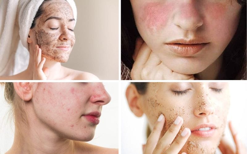 Routine chăm sóc da tuổi 30: Bí quyết duy trì làn da tươi trẻ 4 Routine Chăm Sóc Da Tuổi 30: Bí Quyết Duy Trì Làn Da Tươi Trẻ Và Khỏe Mạnh