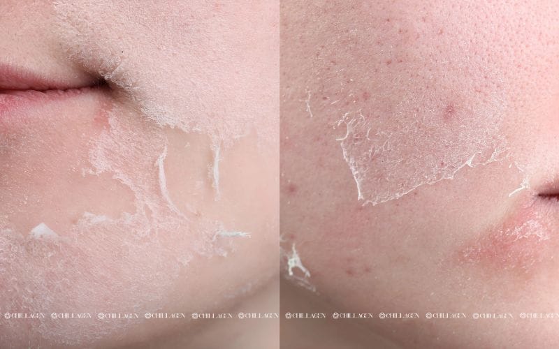 Mặt nạ thiên nhiên cho da khô: 7 công thức dưỡng ẩm hiệu quả tại nhà