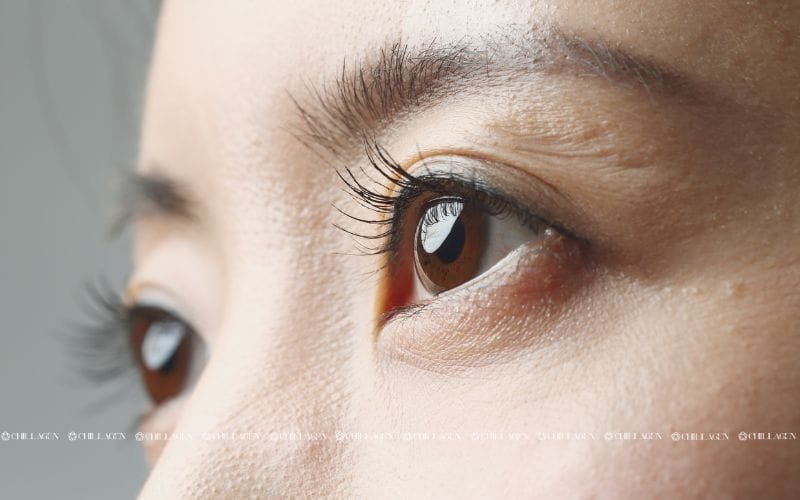 Các loại thực phẩm tốt cho mắt: Bảo vệ thị lực và nuôi dưỡng đôi mắt sáng khỏe 