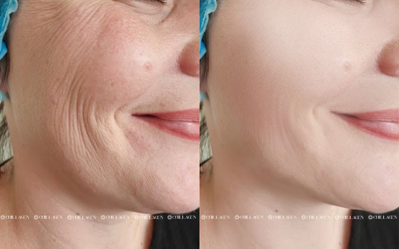 Cách chăm sóc da lão hóa: Giữ gìn làn da săn chắc và tươi trẻ lâu dài 2 Cách chăm sóc da lão hóa: Giữ gìn làn da săn chắc và tươi trẻ lâu dài