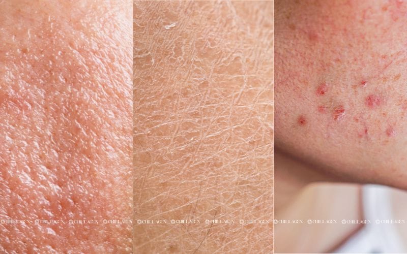 Cách chăm sóc làn da tự nhiên: Bí quyết giúp da sáng khỏe không cần mỹ phẩm đắt tiền 2 Cách chăm sóc làn da tự nhiên: Bí quyết giúp da sáng khỏe không cần mỹ phẩm đắt tiền