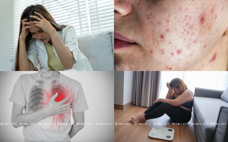 Cách chữa mất ngủ tự nhiên: Giải pháp ngủ sâu và tràn đầy năng lượng 2 Cách chữa mất ngủ tự nhiên: Giải pháp ngủ sâu và tràn đầy năng lượng