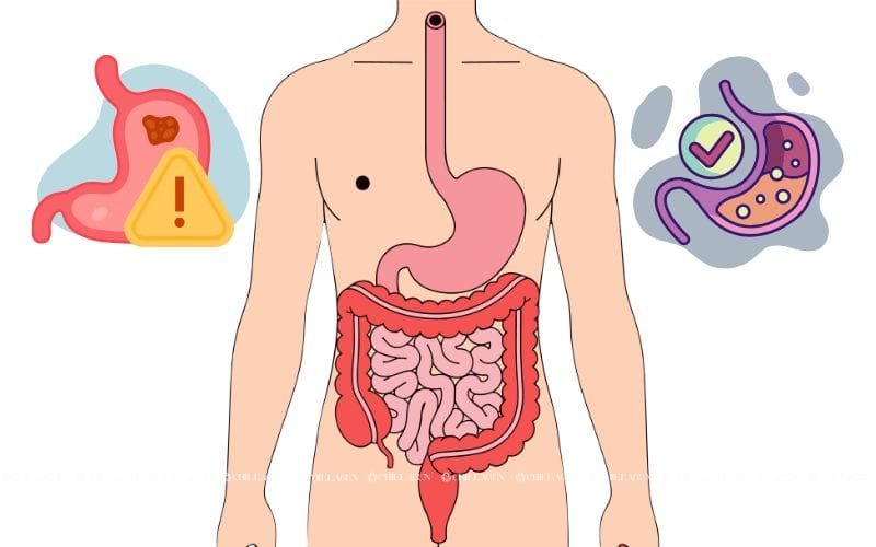 Thực phẩm giúp cải thiện hệ tiêu hóa: Ăn ngon, hấp thu tốt và sống khỏe mỗi ngày