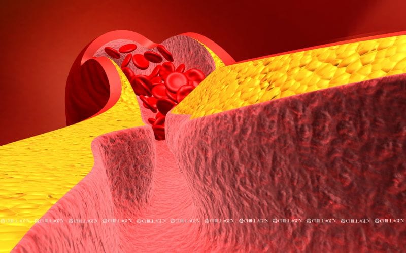 Thực phẩm giúp giảm mỡ máu: Ăn đúng cách để bảo vệ tim mạch và sức khỏe lâu dài