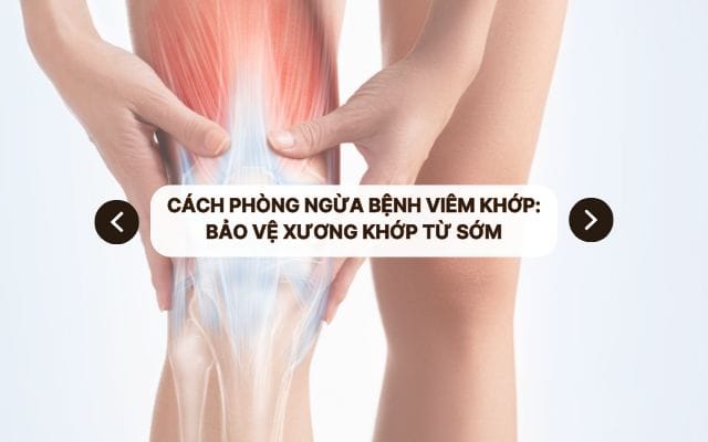 Cách phòng ngừa bệnh viêm khớp: Bảo vệ xương khớp từ sớm