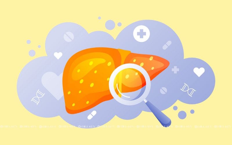 Các triệu chứng của bệnh gan: Dấu hiệu nhận biết sớm 1 Các triệu chứng của bệnh gan: Dấu hiệu nhận biết sớm để bảo vệ sức khỏe