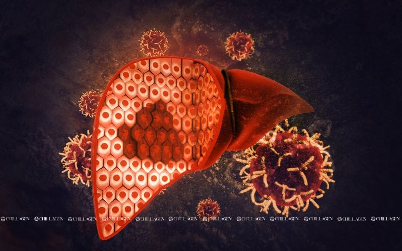 Các triệu chứng của bệnh gan: Dấu hiệu nhận biết sớm 3 Các triệu chứng của bệnh gan: Dấu hiệu nhận biết sớm để bảo vệ sức khỏe