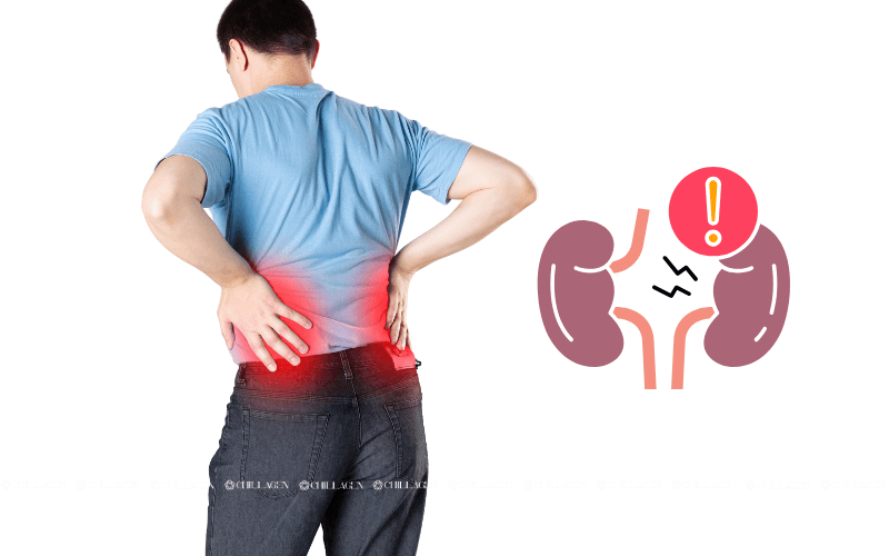 Cách phòng ngừa bệnh suy thận: Bảo vệ chức năng thận từ sớm 2 Cách phòng ngừa bệnh suy thận: Bảo vệ chức năng thận từ sớm